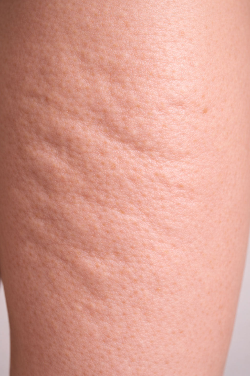 LabSkin 
